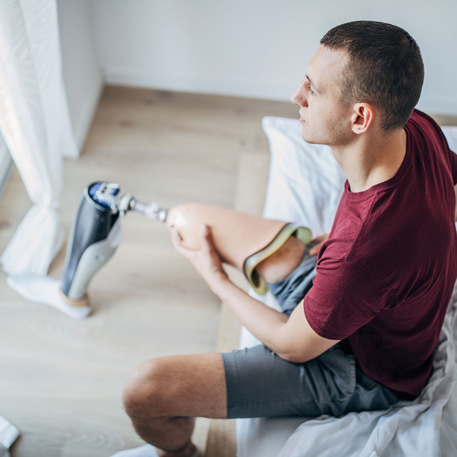 A man with a prosthetic leg sits on the edge of a bed. Workers’ compensation for loss of limb/amputations covers many different injuries that you can suffer on the job.